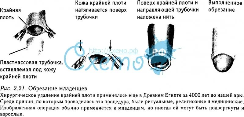 Короткий половой акт. Как продлить половой акт